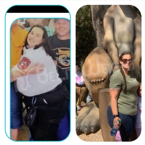 Rachel S - 2 Year Update*